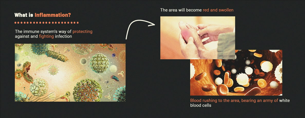 Cannabis and Inflammation: What's the Relationship?