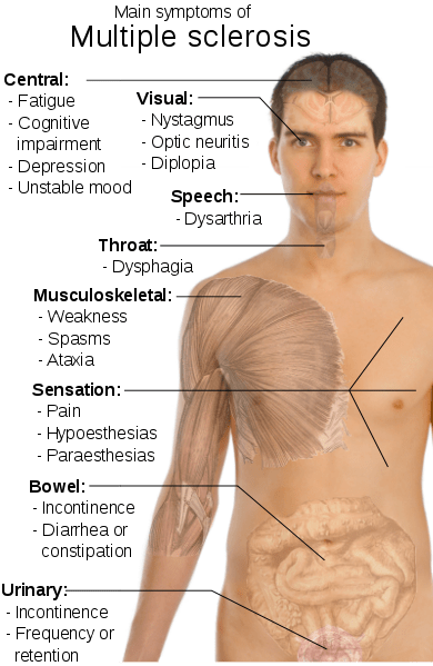 Multiple Sclerosis and cannabis