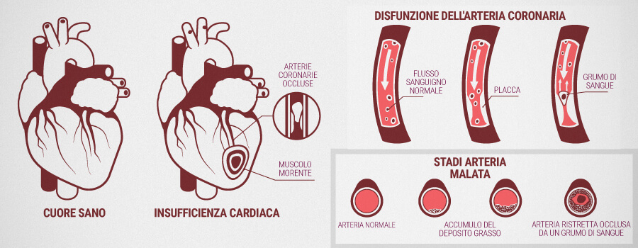 Problemi Cardiaci E Come Può Aiutare Il Cbd Problemi Cardiaci E Come Può Aiutare Il Cbd