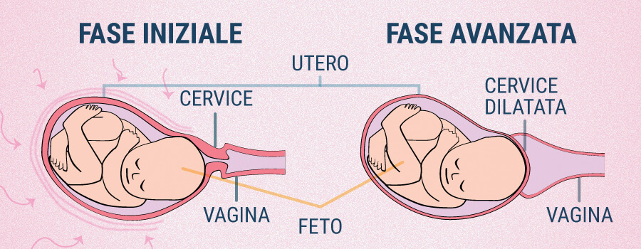Contrazioni Uterine E Cbd Contrazioni Uterine E Cbd