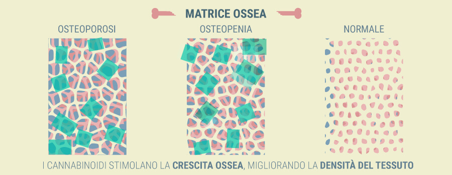 Osteoporosi CBD Osteoporosi CBD