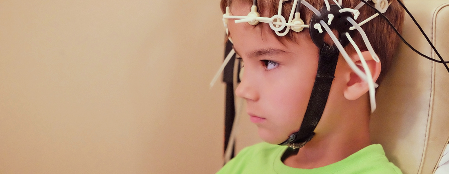 Bambini sindrome di Dravet di epilessia