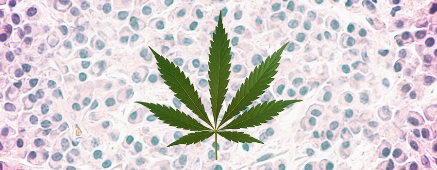 Leucemia Cannabis