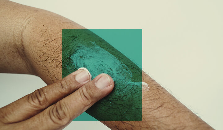 Come usare il CBD per la cura della pelle? Come usare il CBD per la cura della pelle?