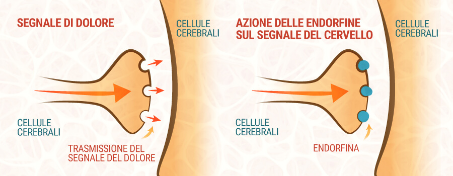 Segnale Del Dolore E Endorfine Segnale Del Dolore E Endorfine