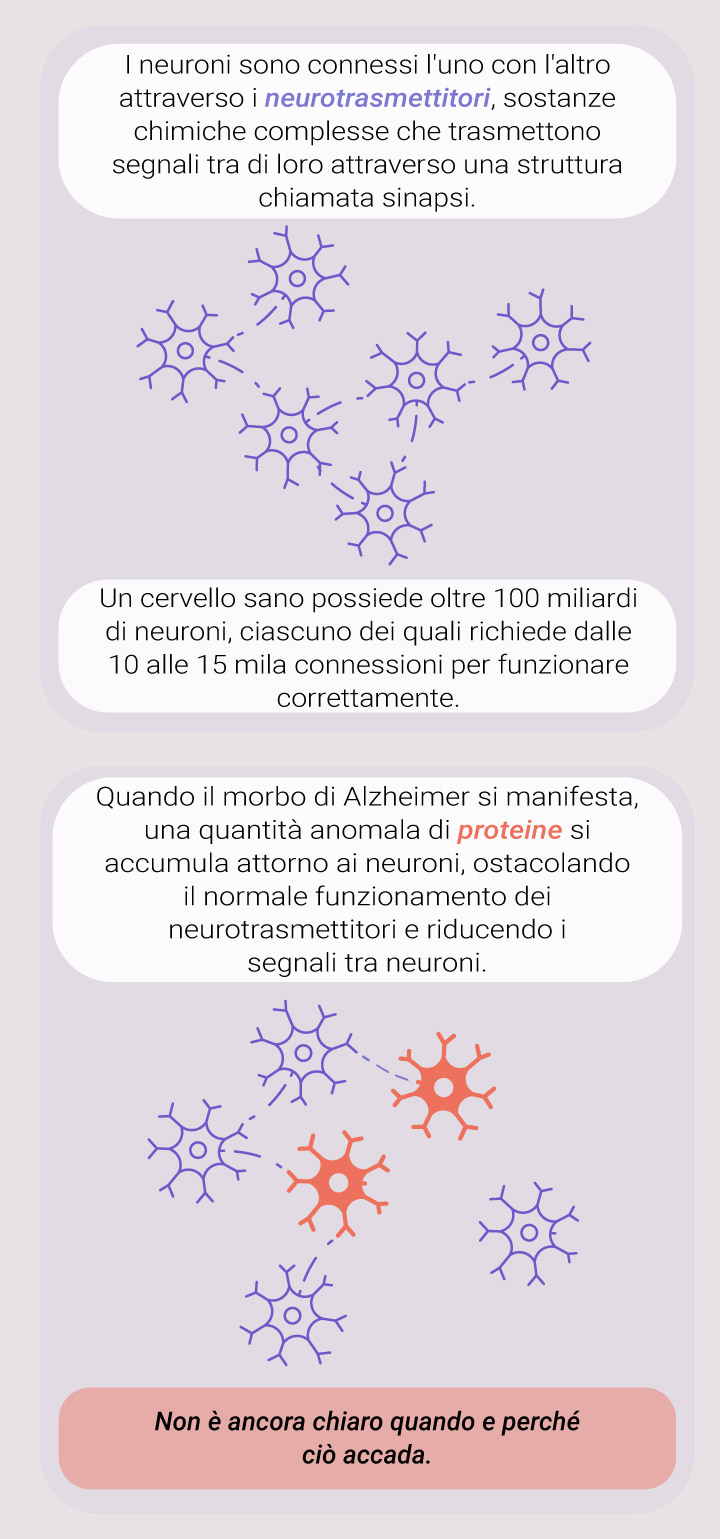 What Causes Alzheimer What Causes Alzheimer