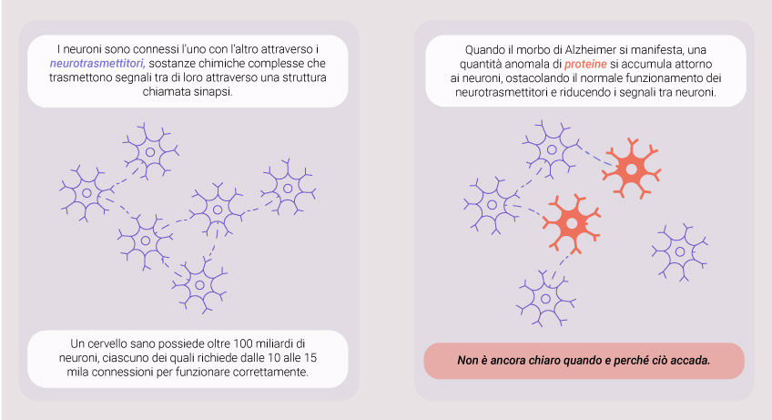 What Causes Alzheimer What Causes Alzheimer