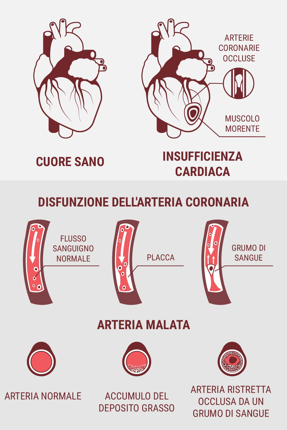 Le malattie cardiovascolari e le malattie cardiache sono la stessa cosa?