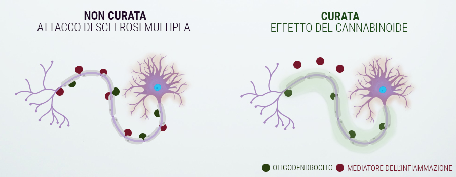USARE LA CANNABIS CONTRO LA SCLEROSI MULTIPLA USARE LA CANNABIS CONTRO LA SCLEROSI MULTIPLA