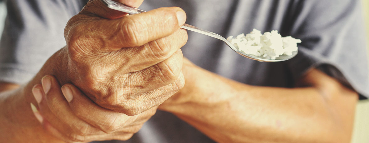 Effetti del morbo di Parkinson sull'organismo Effetti del morbo di Parkinson sull'organismo
