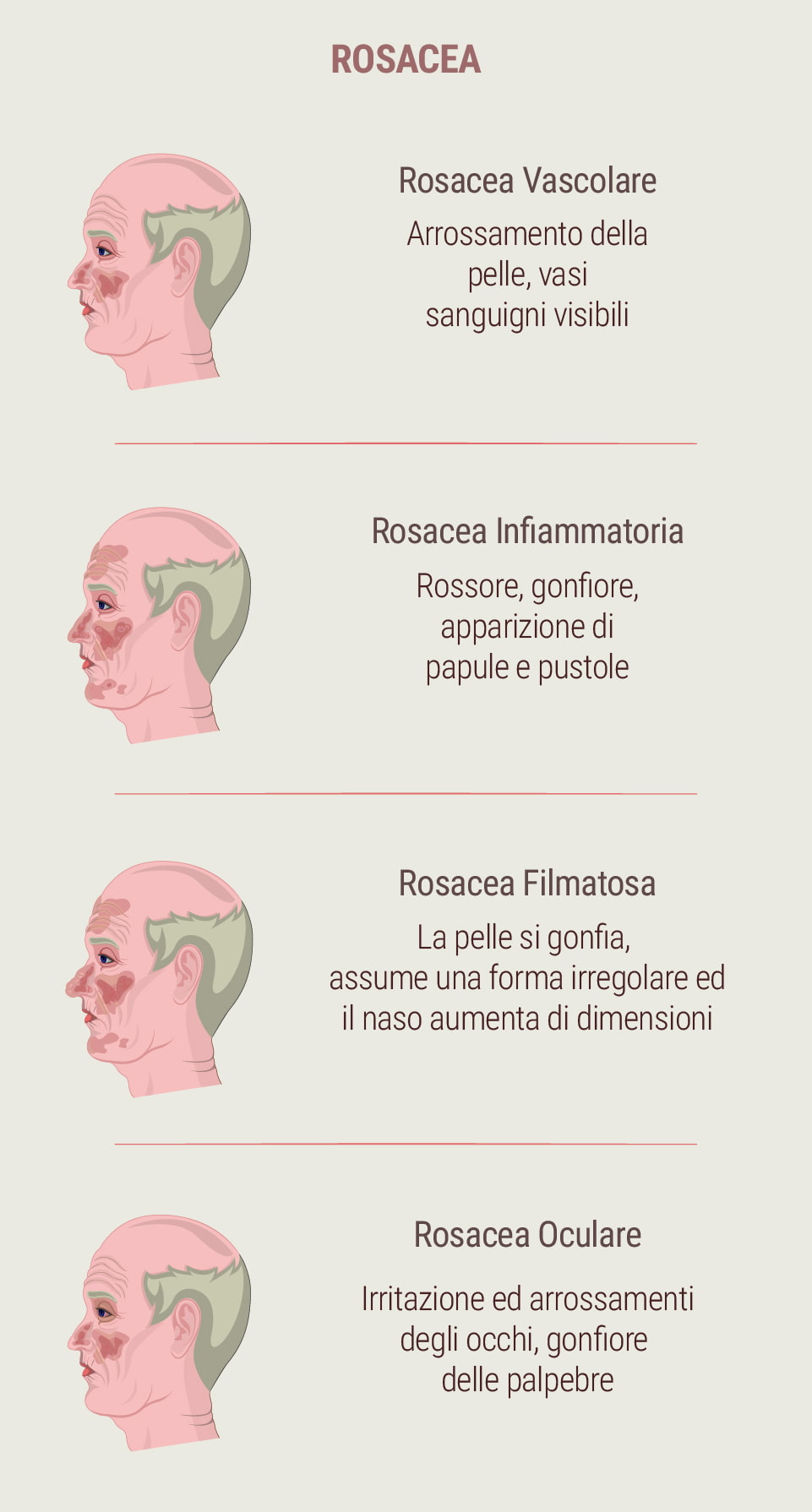 Cos'è la rosacea?