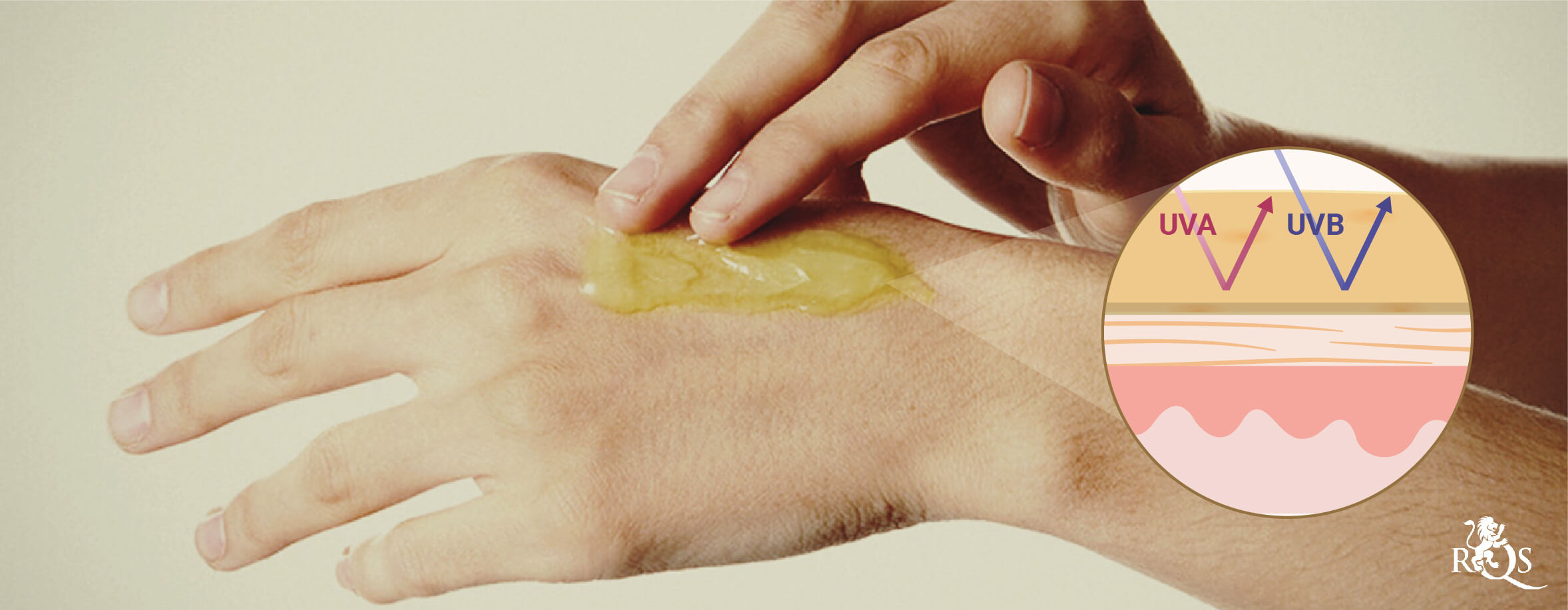 Le Lozioni Contenenti CBD Possono Alleviare i Sintomi di una Scottatura? Le Lozioni Contenenti CBD Possono Alleviare i Sintomi di una Scottatura?