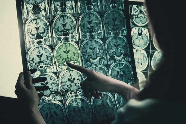 La Cannabis È Efficace Per Le Persone Con Disabilità?